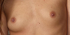 Ant Bite Breasts Tanned